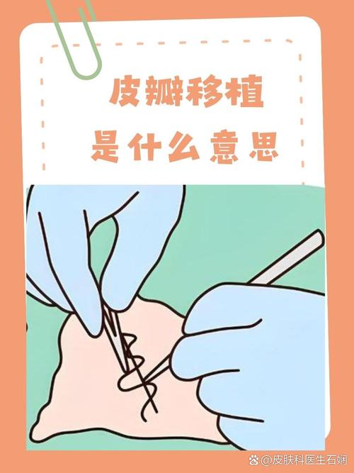 ios上有帝国时代吗;ios帝国时代类游戏 - 888游戏网