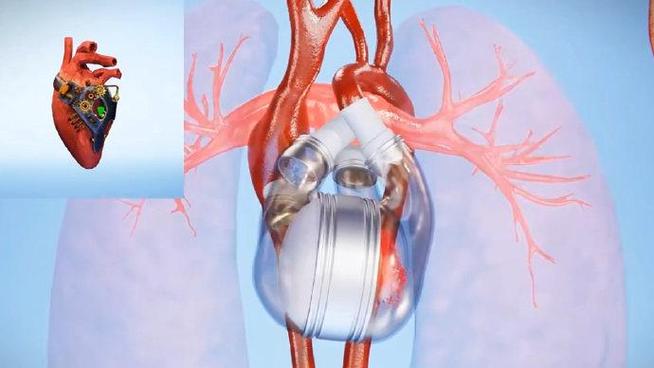 雷伊怎么变成完全体_雷伊怎么变成完全体的人 - 888游戏网